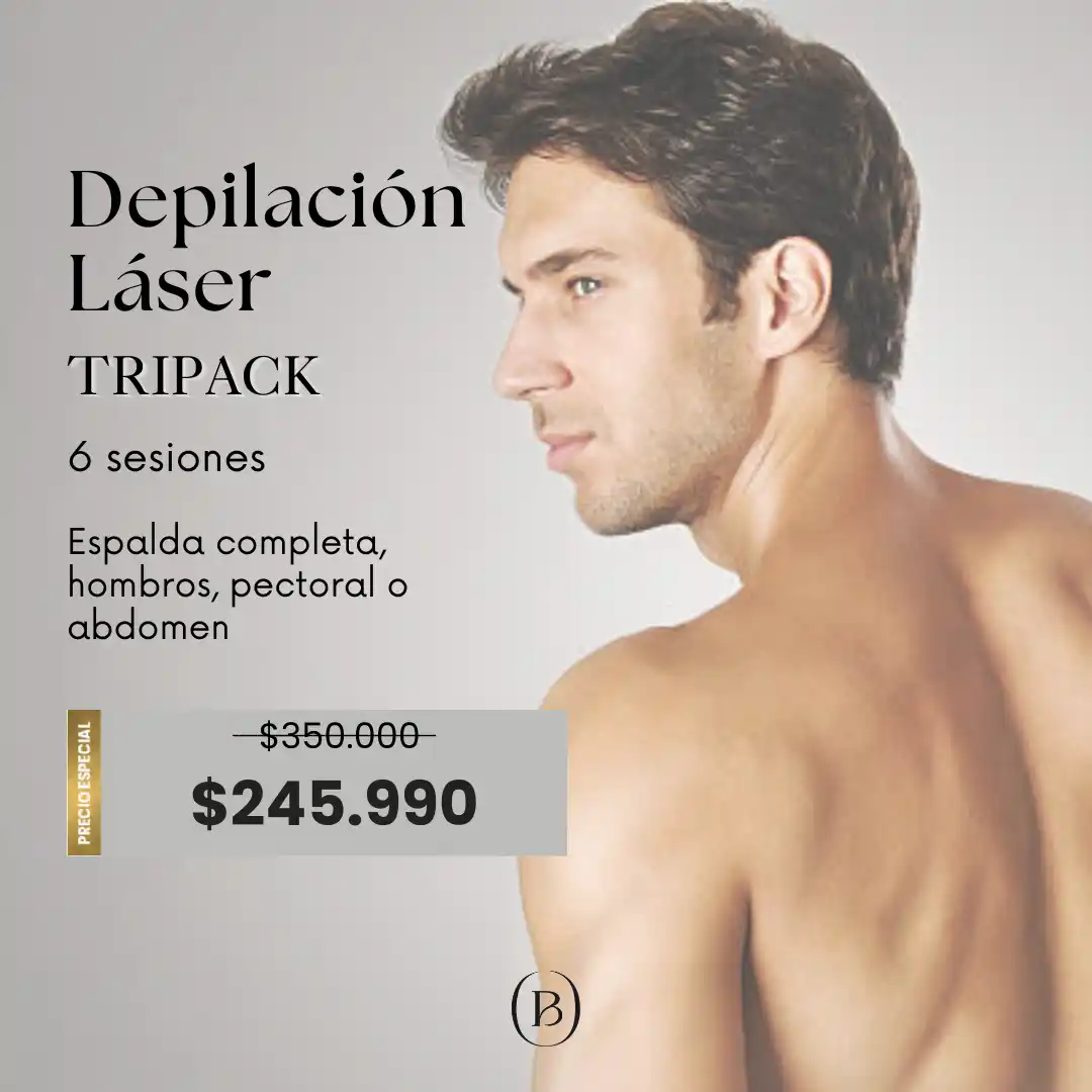 Depilacion Laser TRIPACK MASC